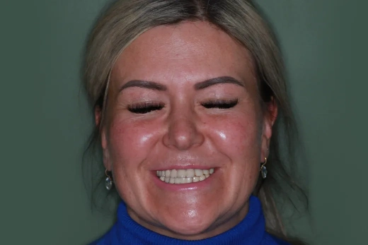 Множественные сколы и периодические боли 