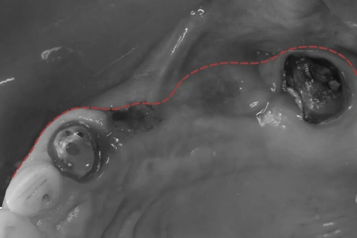 Реферативная работа с мягкими тканями
