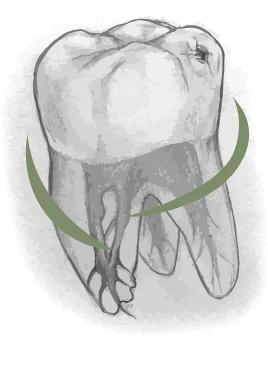 Лечение зубов с использованием микроскопа