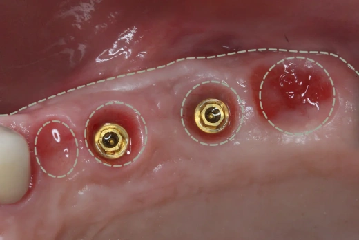 Реферативная работа с мягкими тканями