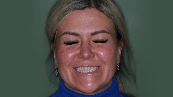 Множественные сколы и периодические боли 