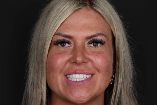 Множественные сколы и периодические боли 