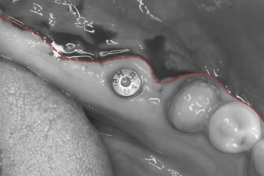 Реферативная работа с мягкими тканями