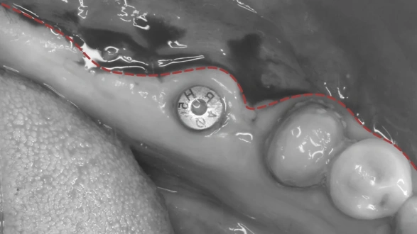 Реферативная работа с мягкими тканями