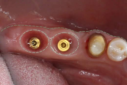 Реферативная работа с мягкими тканями