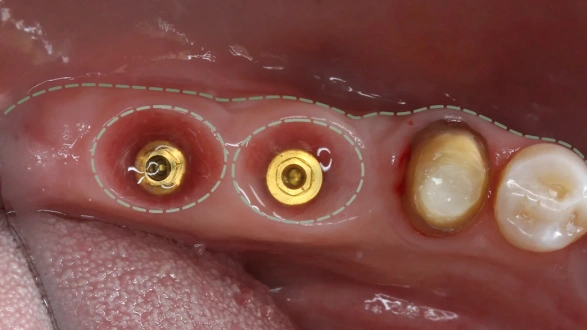 Реферативная работа с мягкими тканями